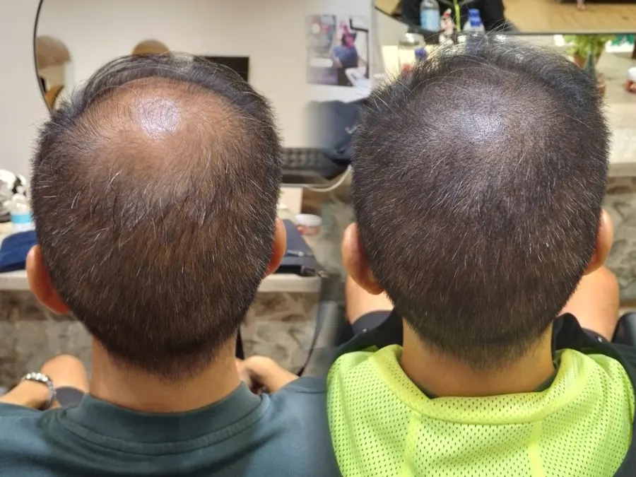 Before and after 1 session, photo 7