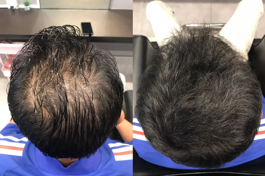 Before and after 1 session, photo 8